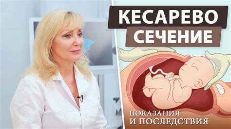 Кесарево сечение: когда необходимо и как проходит операция