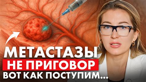 Когда беременность маскирует рак: можно ли было предотвратить метастазы у Лерчек