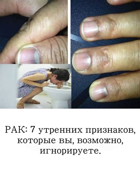 Рождение ребёнка и защита от рака: что важно знать